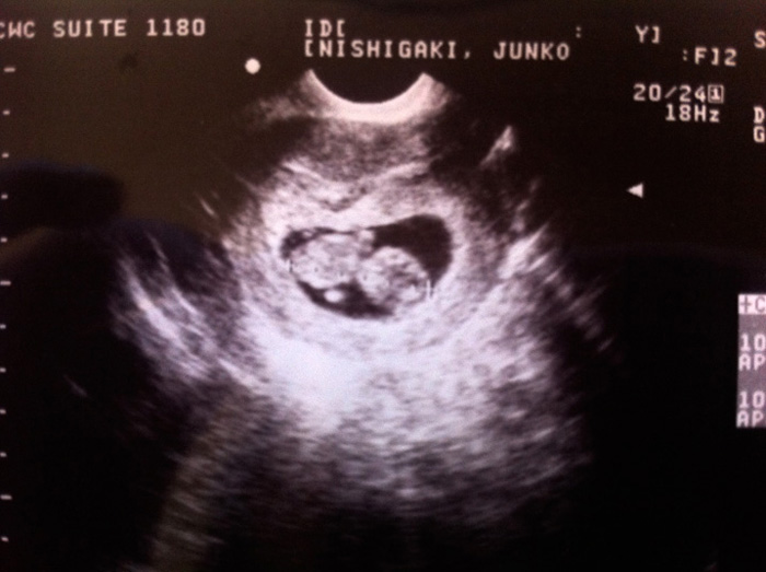 コドモハワイ | LLLLIFE,INC.