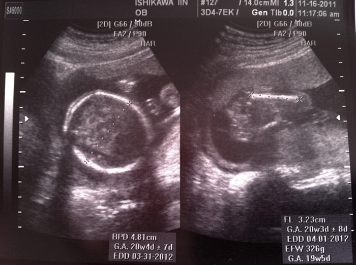 コドモハワイ | LLLLIFE,INC.